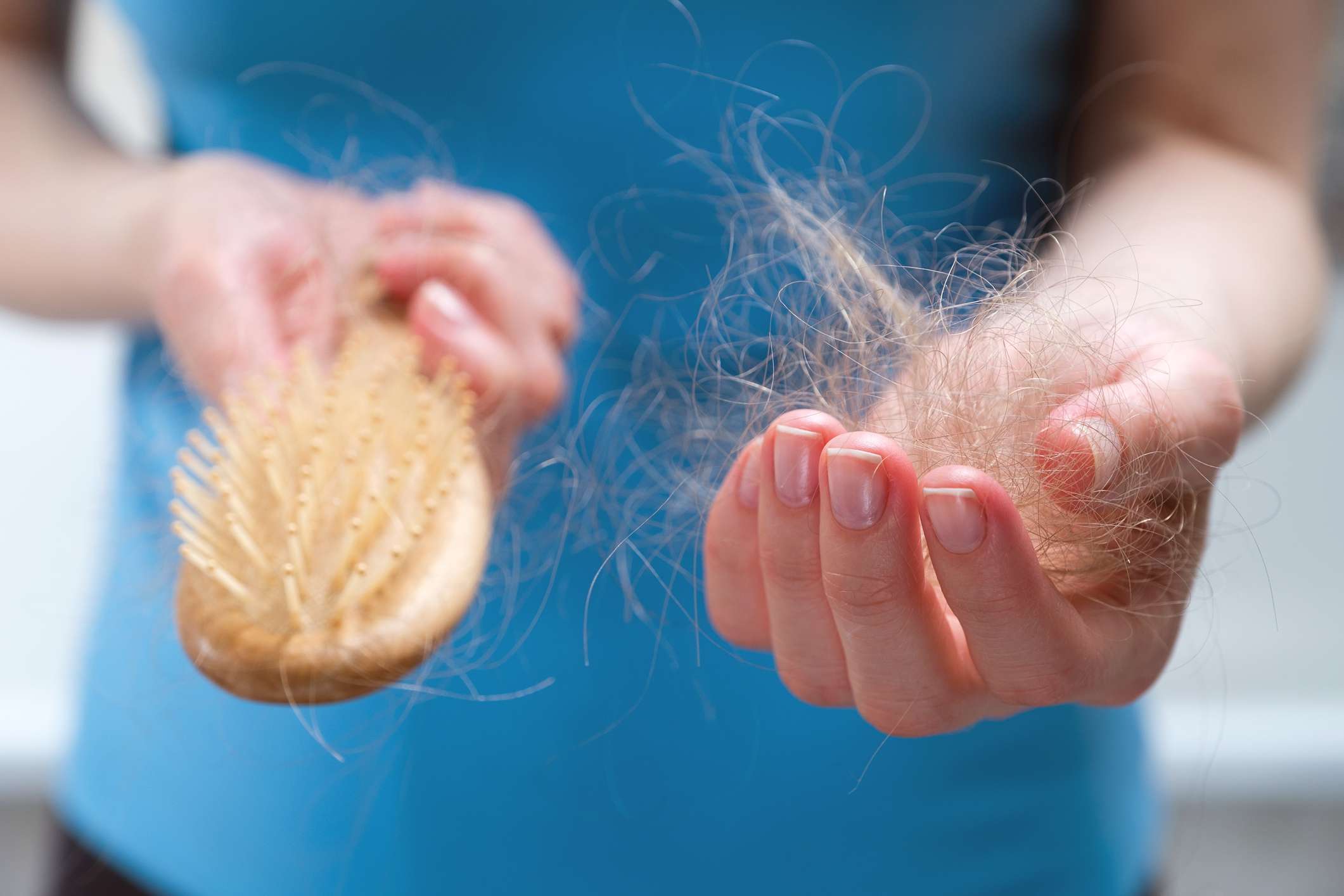 Reason for hair loss